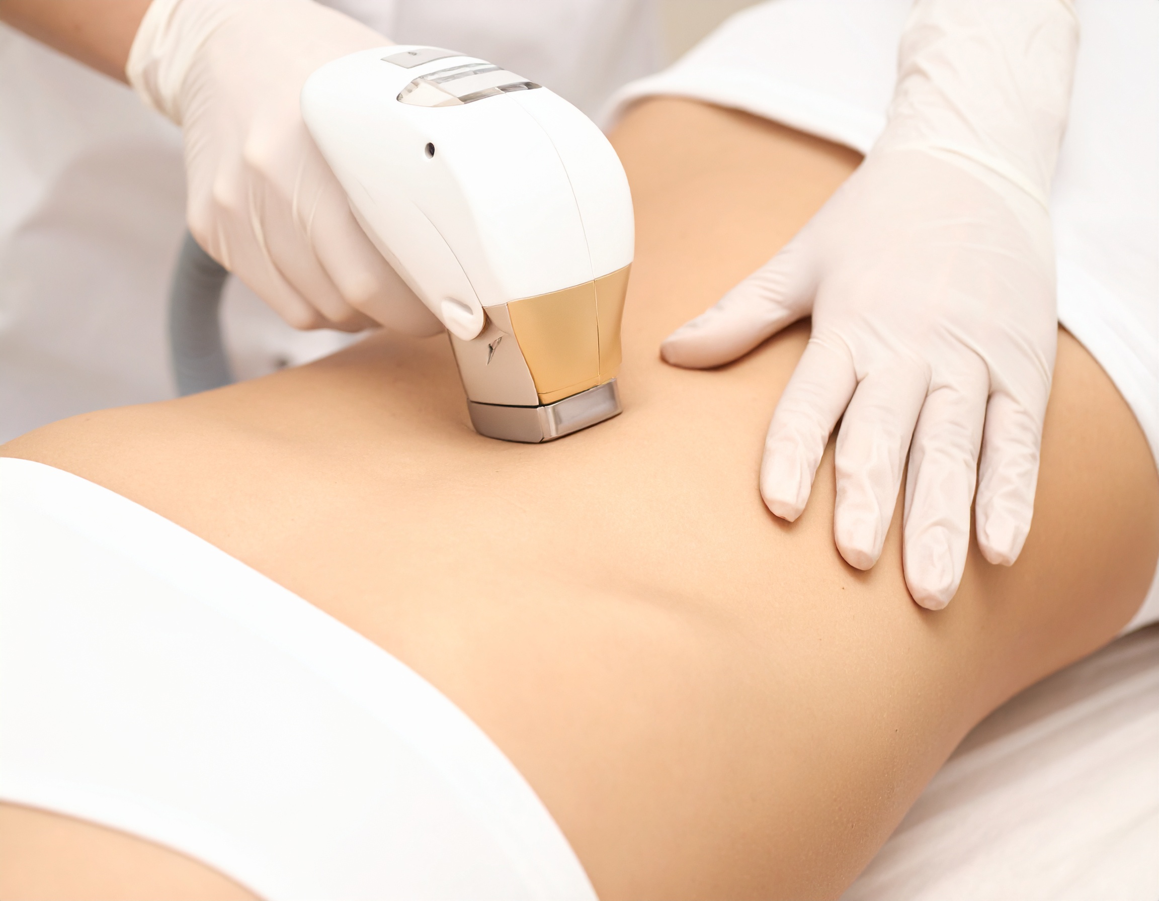 Adelgazamiento localizado y general